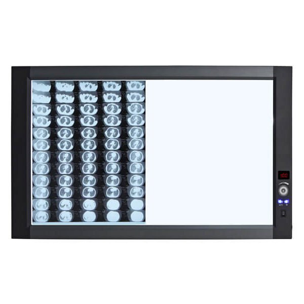 Ultra-Bright LED X-Ray Film Viewer(Back Light Mode)