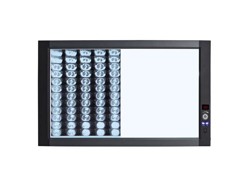 Ultra-Bright LED X-Ray Film Viewer(Back Light Mode)